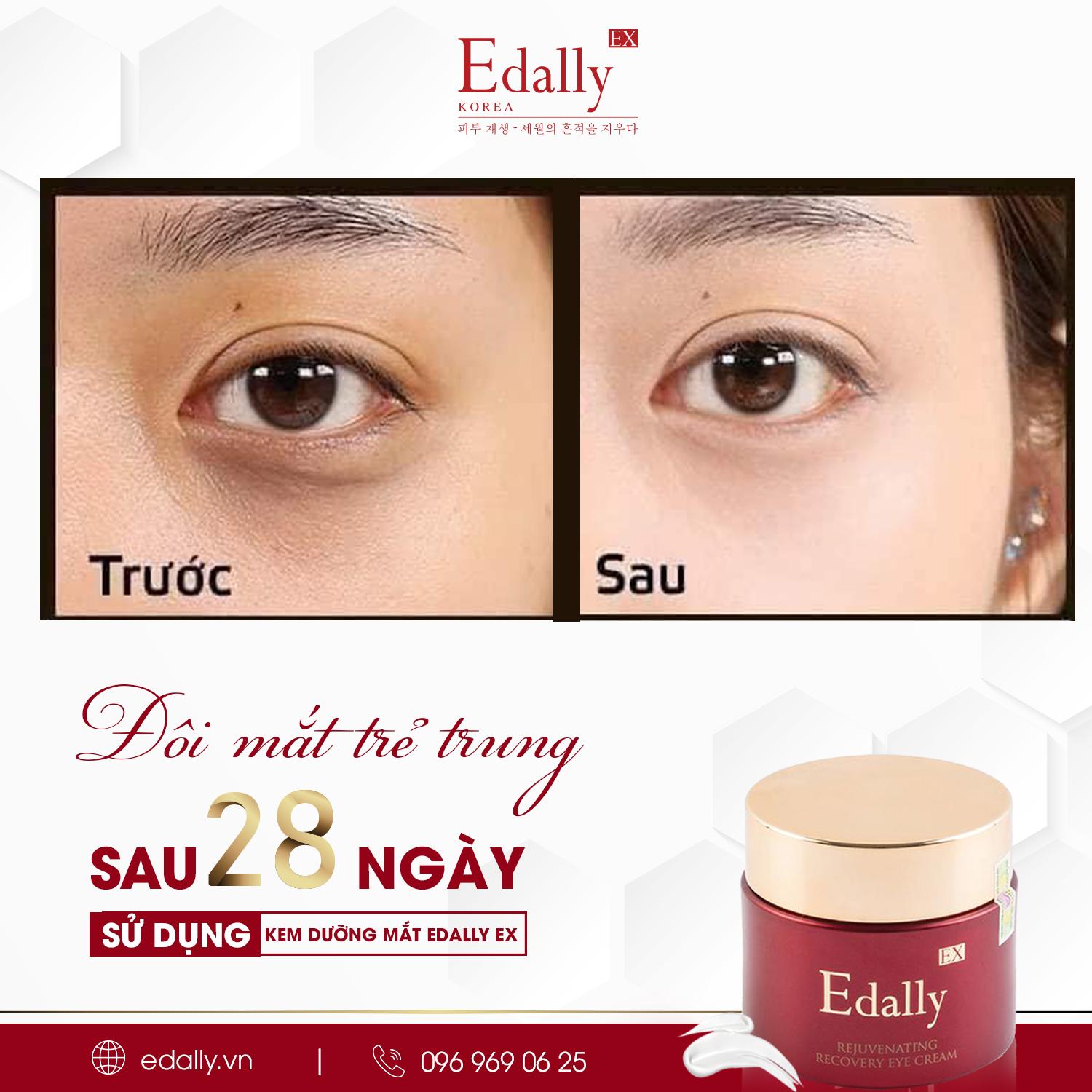[CHÍNH HÃNG] Kem dưỡng mắt Edally.