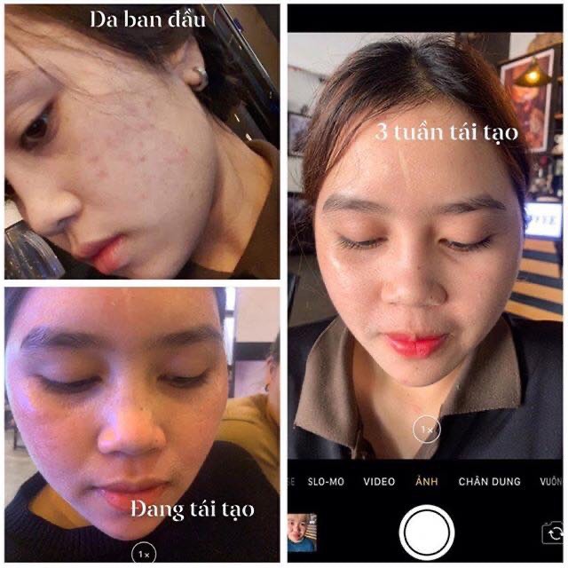 [HCM]KEM TÁI TẠO CHAMOMILESKILL