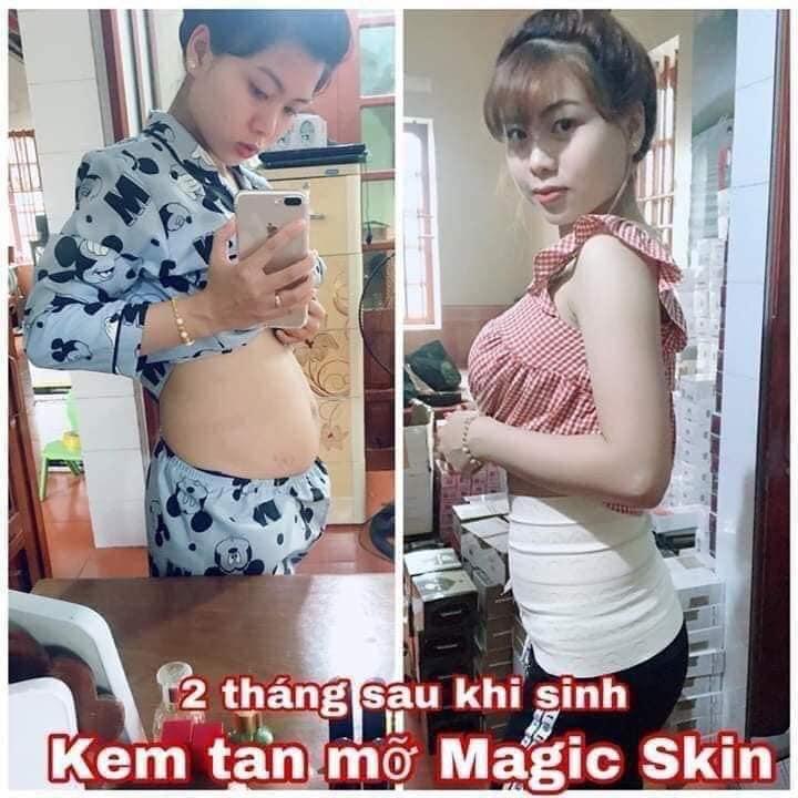 Kem Tan Mỡ Magic Skin