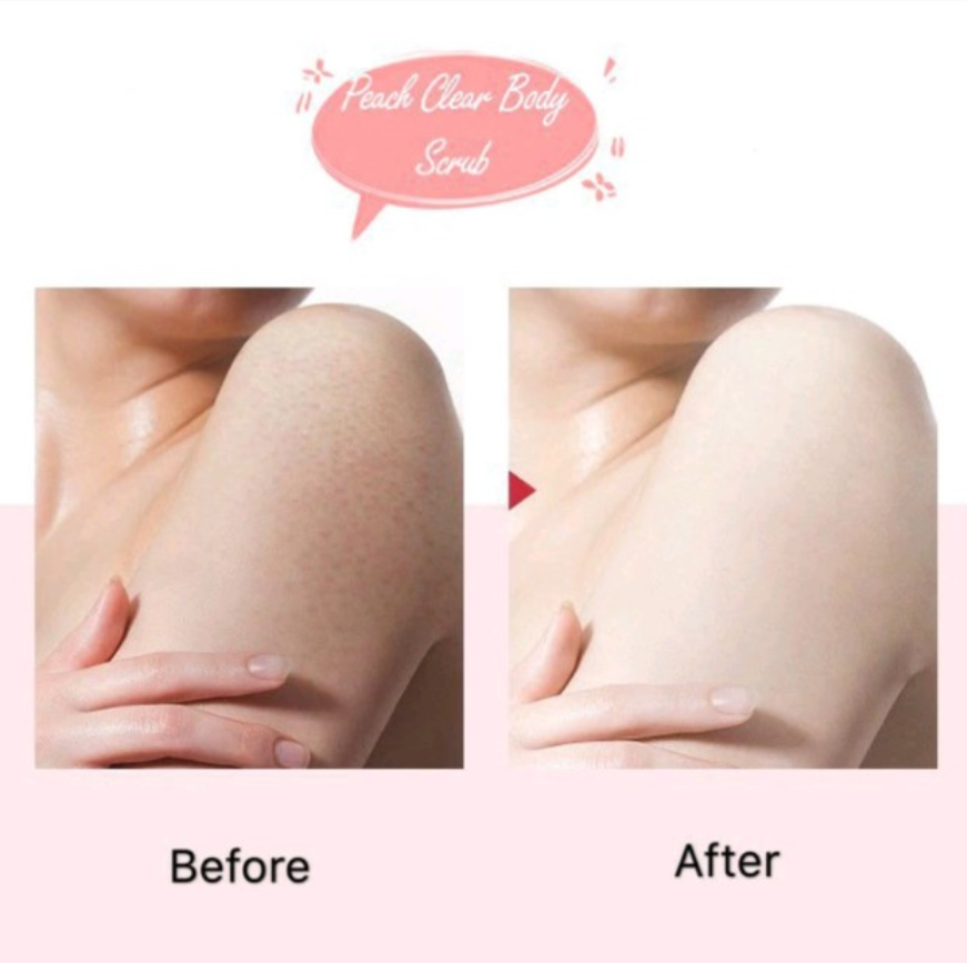 Tẩy Da Chết Body Đào Heyxi 200ML