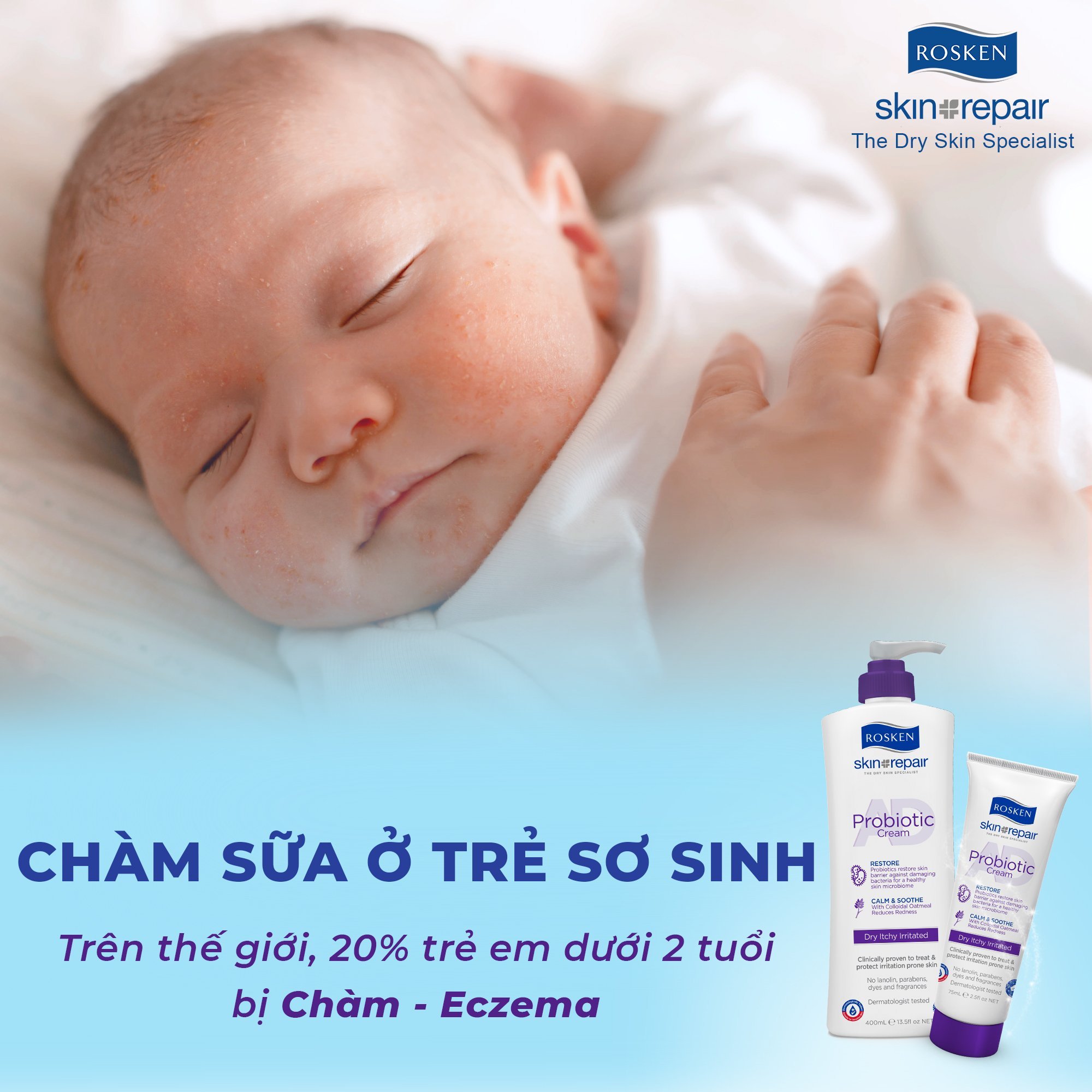 HCM [ TEM CÔNG TY] Chăm Sóc Da Khô, Chàm, Vảy Nến - ROSKEN AD Probiotic  75mL & 400mL