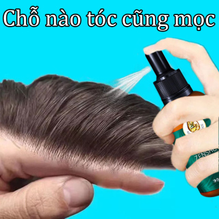 HCM CHÍNH HÃNG 100% Tinh dầu mọc tóc Mọc lại tóc 30ml nuôi dưỡng tóc tinh thumbnail