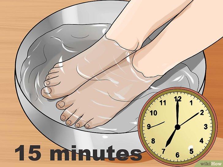 Dụng cụ chữa móng quặp móng chân chọc thịt đau đớn