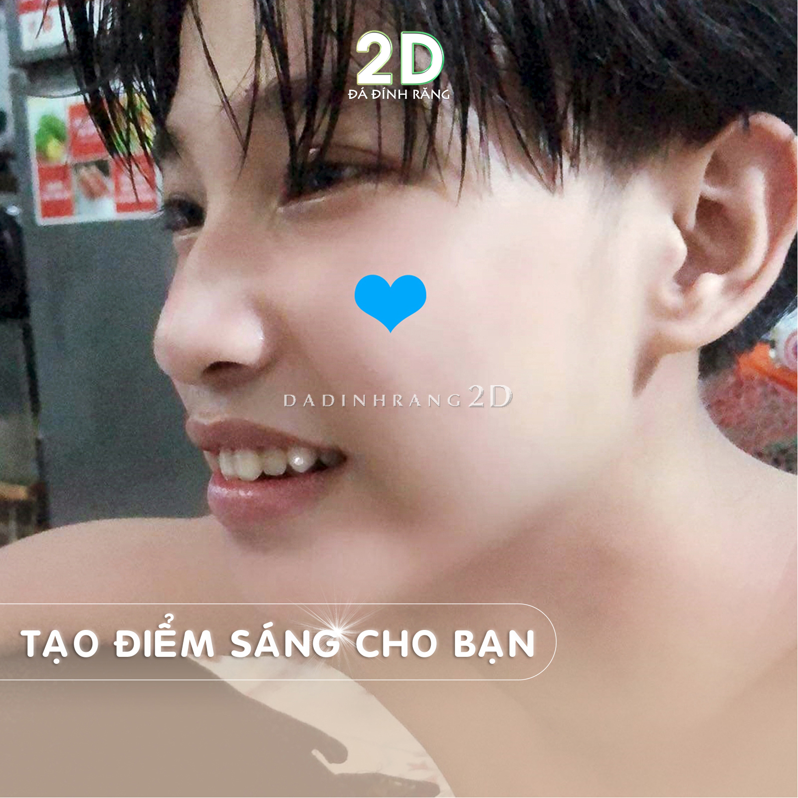 Đá Đính Răng Tại Nhà Đủ Size + Tặng Keo Dán