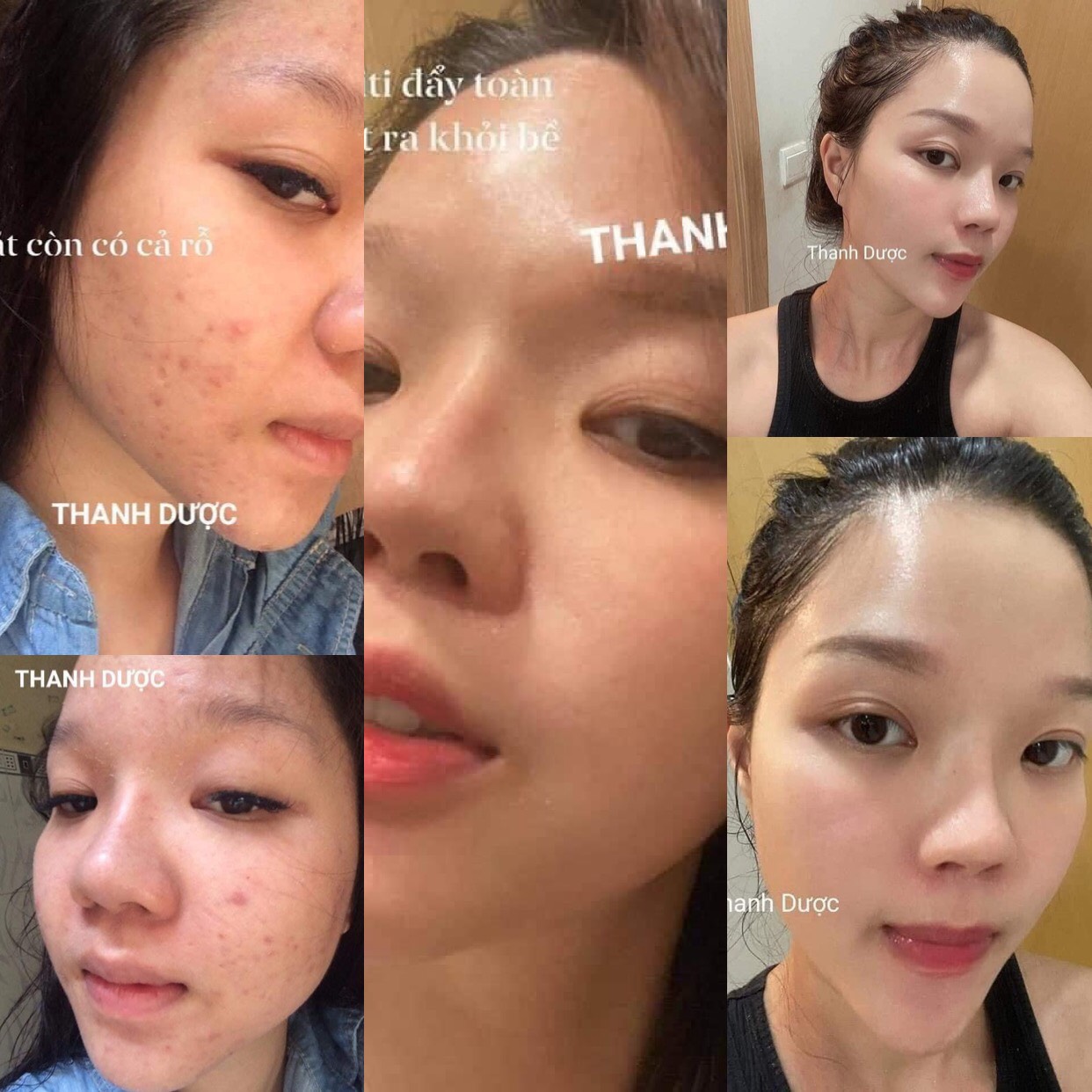 Combo 2 Serum Thảo Mộc Thanh Dược Lare 80ml