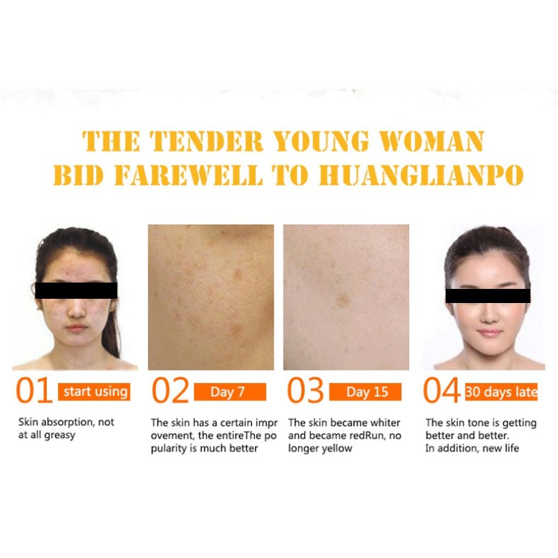 Serum Trắng Da Mờ Thâm Disaar Vitamin C 30ml