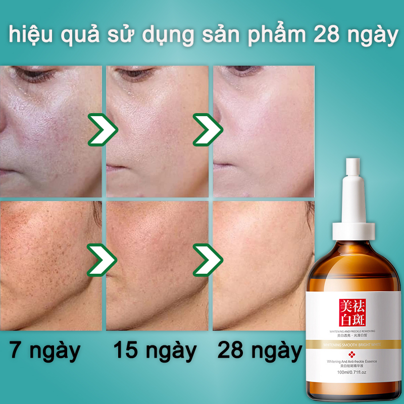 tinh chất làm trắng serum thâm mụn Huyết thanh chống tàn nhang sử dụng trắng hết nhăn nám tàn nhang không tì vết chất làm săn chắc lỗ chân lông tinh chất dưỡng ẩm mặt thu nhỏ lỗ chân lông săn chắc 100ml