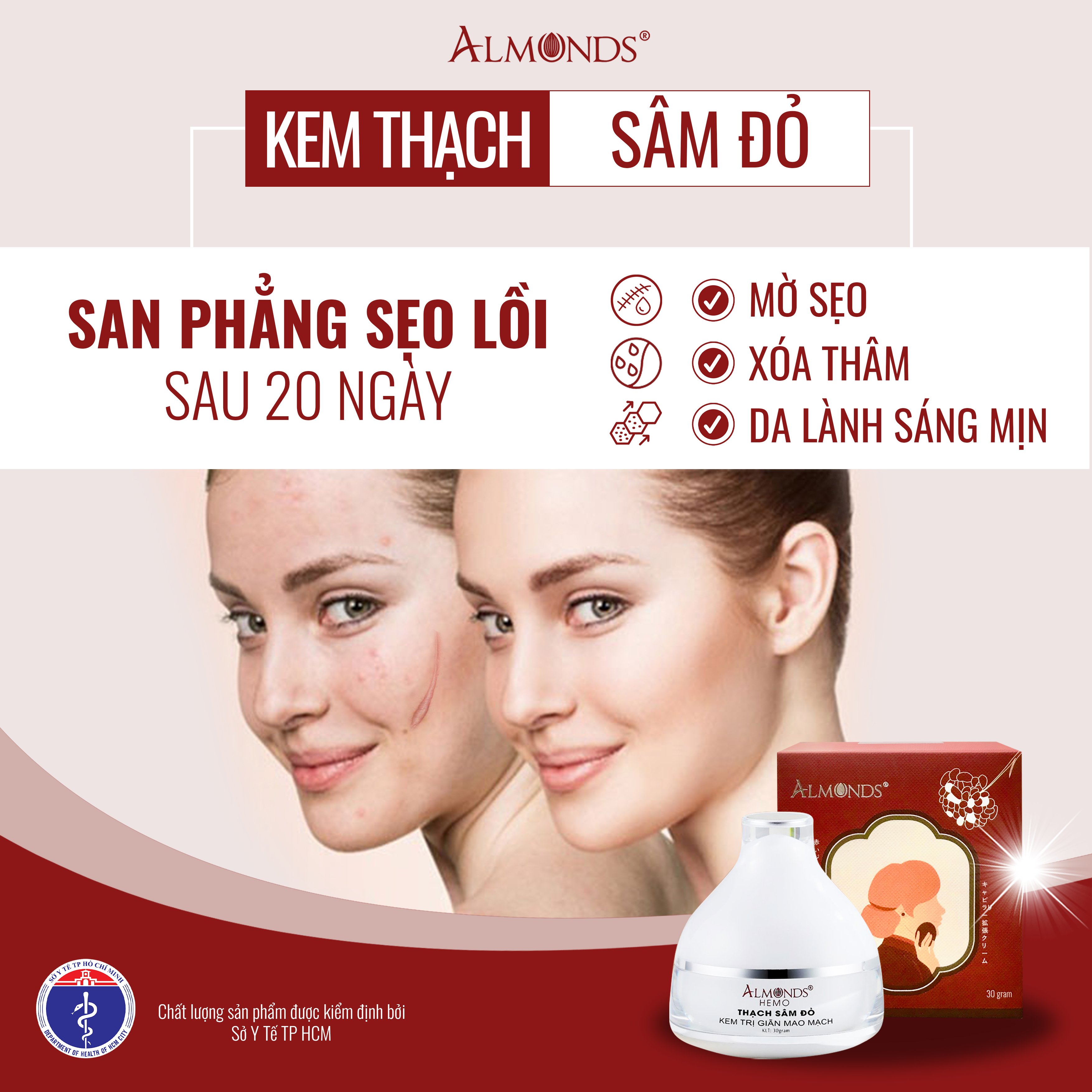 Kem  giãn mao mạch thạch sâm đỏ- HEMO ALMONDS 30g