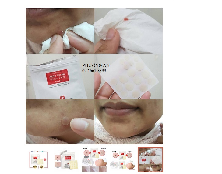 Miếng Dán Mụn Corsx - Acne Pimple Master Patch Cosrx CHÍNH HÃNG