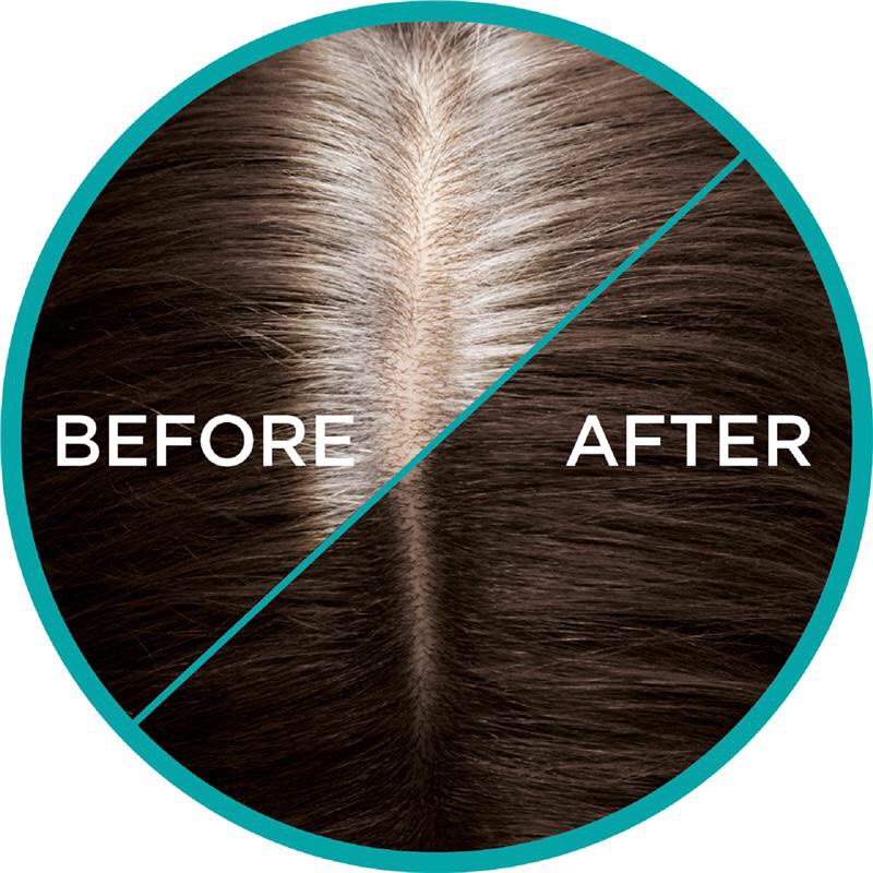 Xịt Nhuộm tóc phủ bạc tạm thời L'Oreal Paris Magic Retouch Temporary Root Concealer Spray - Dark Brown.Nâu đen