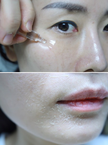 THAY DA SINH HỌC QSCELL THẾ HỆ MỚI