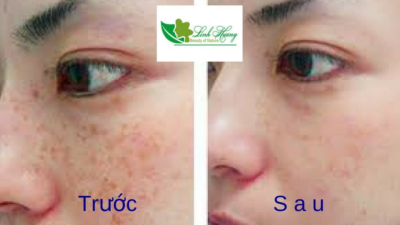 Tinh chất nám Linh Hương