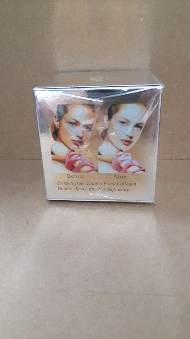 kem Alyna nám tàn nhang đồi mồi