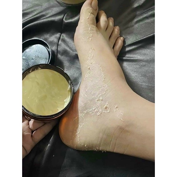 kem body bong da