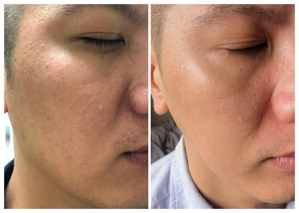 Mặt nạ làm sạch se khít lỗ chân lông Dazzleslim