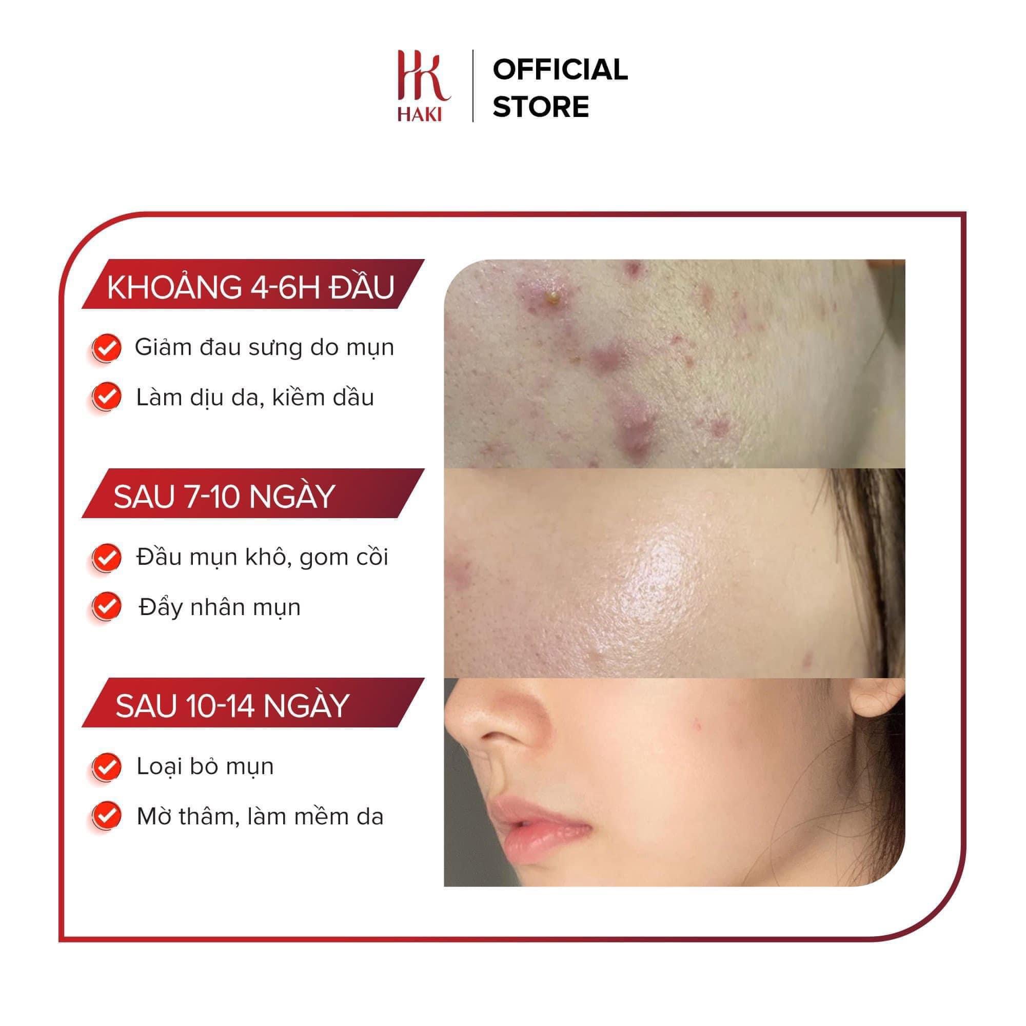 SERUM NGỪA MỤN HAKI GINGEM