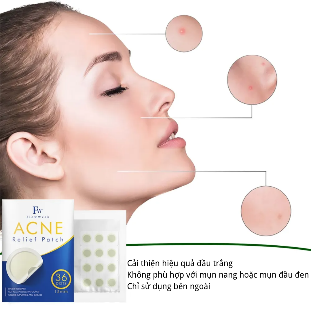Flow Week Miếng dán trị mụn Miếng dán trị mụn Hydrocolloid Miếng dán trị mụn không thấm nước Miếng dán trị mụn Hydrocolloid Miếng dán trị mụn vô hình thoáng khí Miếng dán chống mụn trên mặt