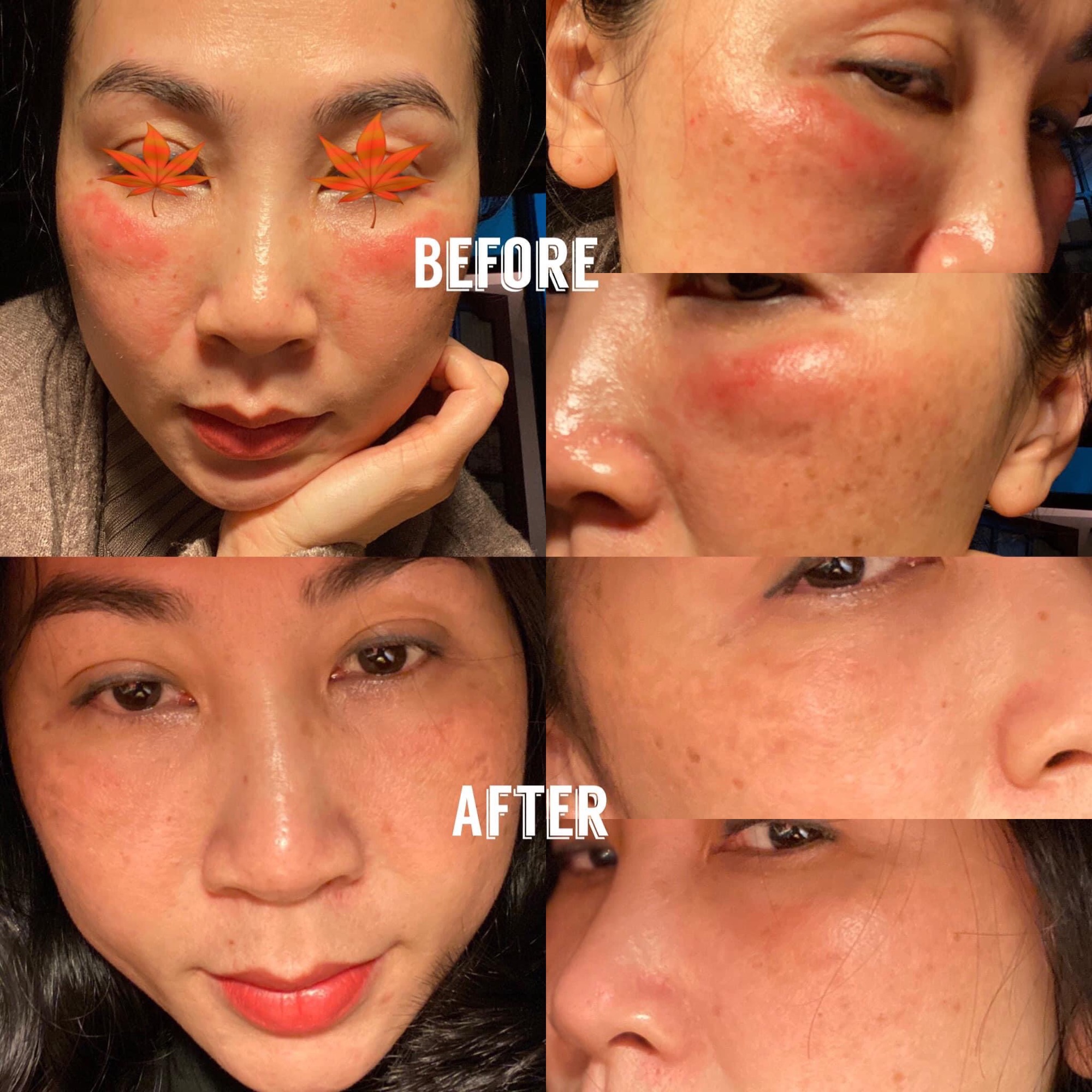 [HCM]1 Cặp Tinh Chất Peptide Đồng - Siêu Phục Hồi