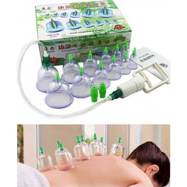 ⛔FREESHIP⛔ Bộ giác hơi không dùng lửa (BỘ 12 MÓN)