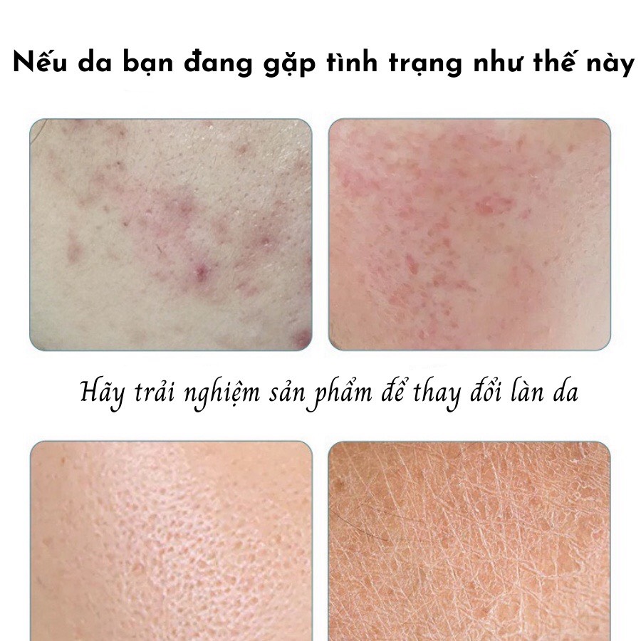 Mặt nạ cao cấp Bioaqua đủ vị