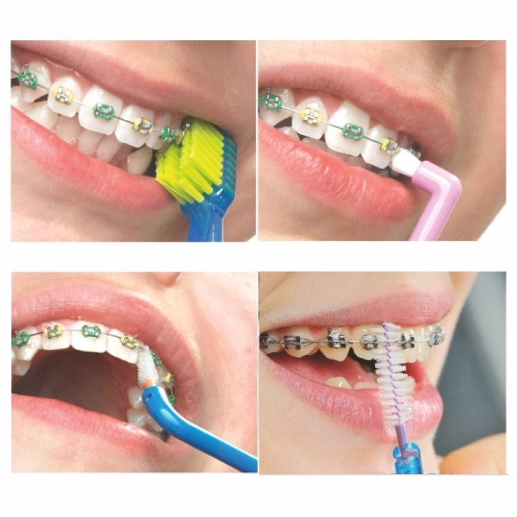Combo 3 vỉ Bàn Chải Kẽ Răng Dạng L Dr.Polir size SSS 0.7mm (Vỉ 6 cây)