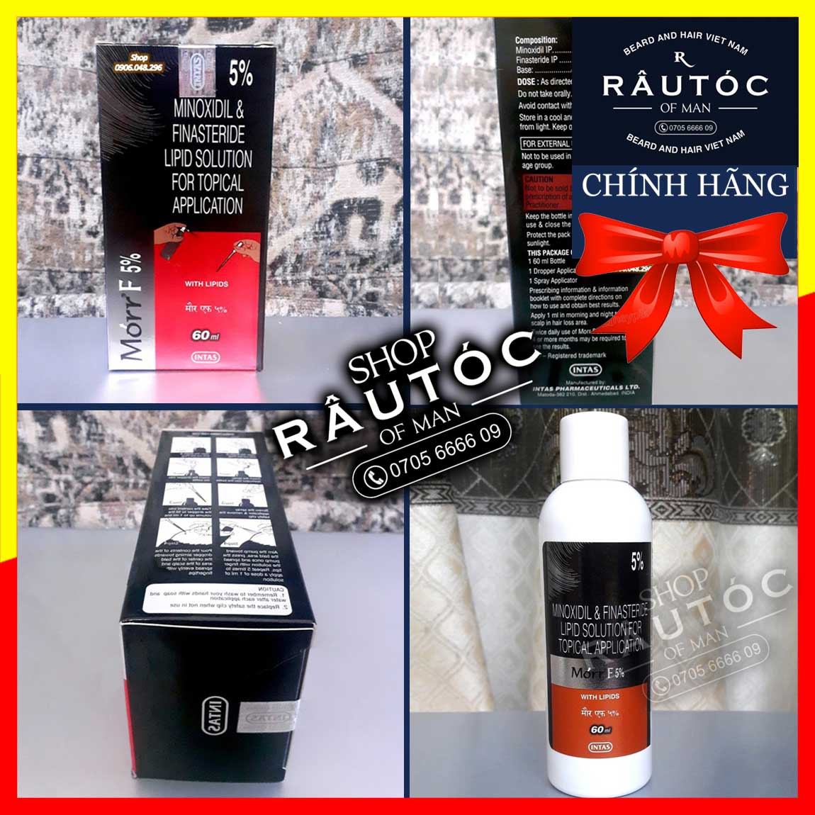 Morr F5 cho Mọc tóc Minoxidil & Finasteride 5%