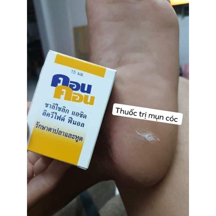 Chấm Mụn Cơm Mụn Cóc ConCon Thái Lan 15ml