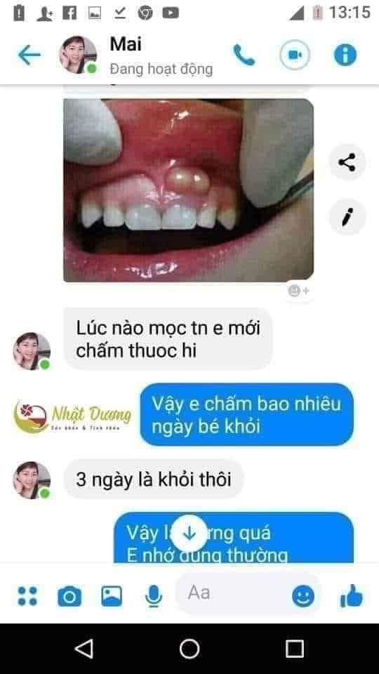 sâu răng nhật dương mẫu mới nhất