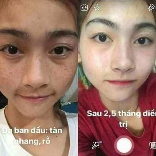 Kem face king Thái Lan 5in1 A Đạt