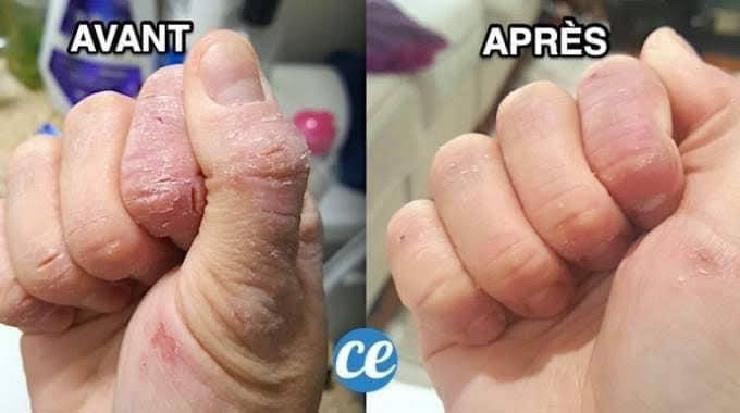Kem ngừa nứt nẻ da tay khô Eucerin 75ML - Bill Pháp