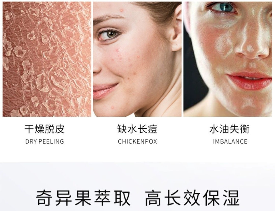 [Combo 6 miếng]Mặt nạ trái cây YINZHUANG