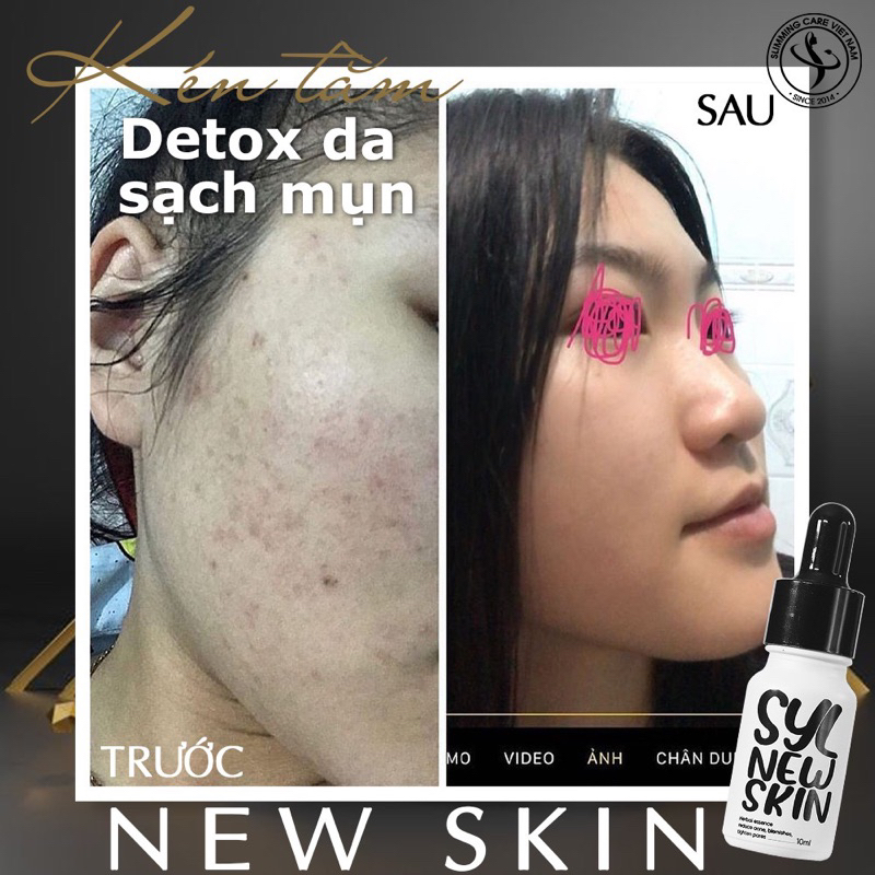 Newskin