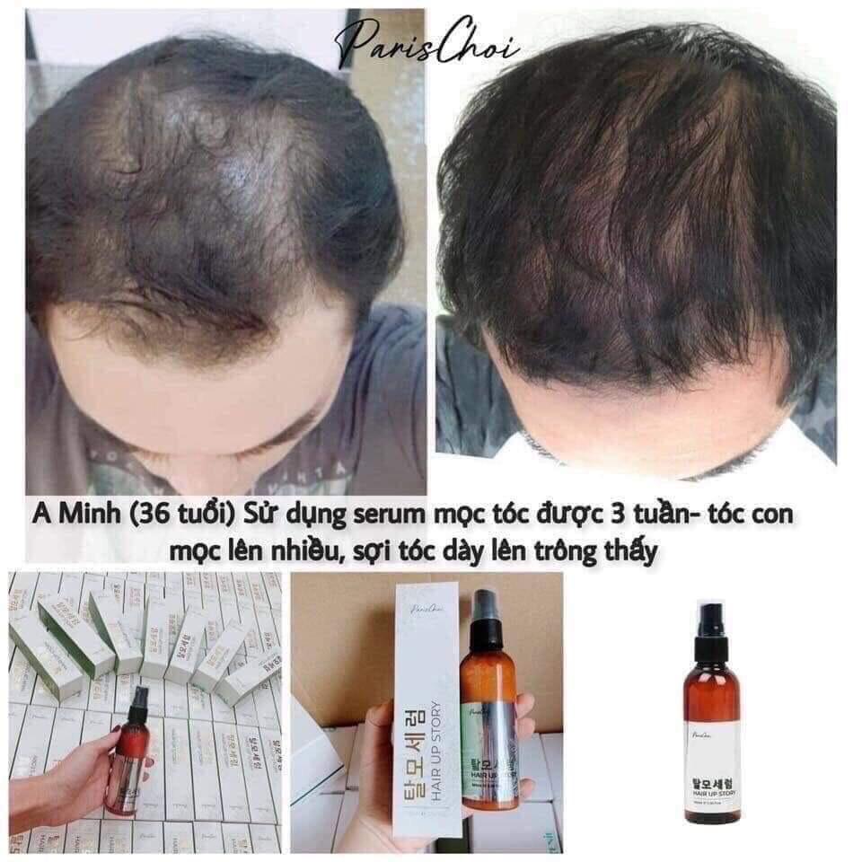 Serum xịt mọc tóc Hair Up Genie Hàn Quốc