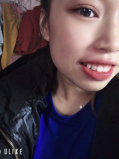 Đá Đính Răng Giá Rẻ ( kim cương nhân tạo gắn răng)
