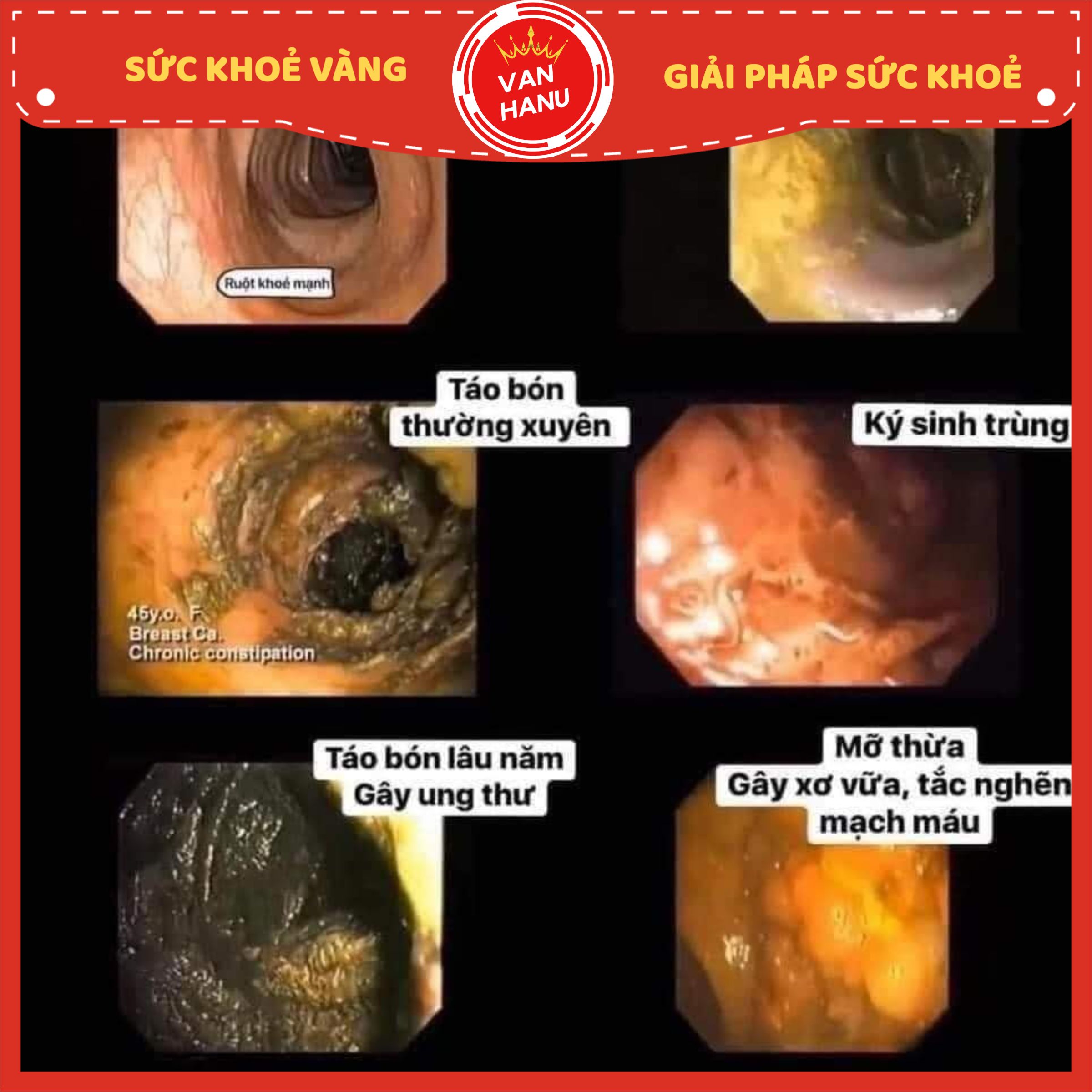 Trà Thải Độc Ruột Già - lifiber - VanHanu - Sức Khoẻ Vàng