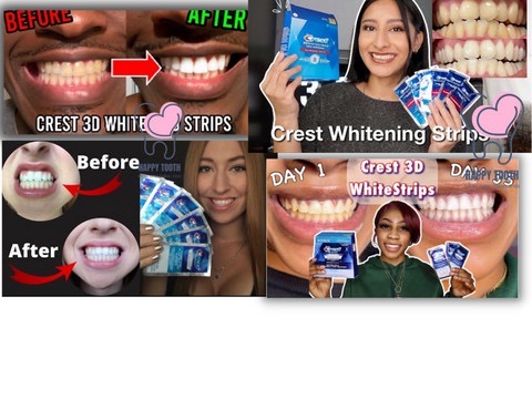 Miếng Dán Trắng Răng Crest 3D White 1 Gói Chính Hãng Mỹ