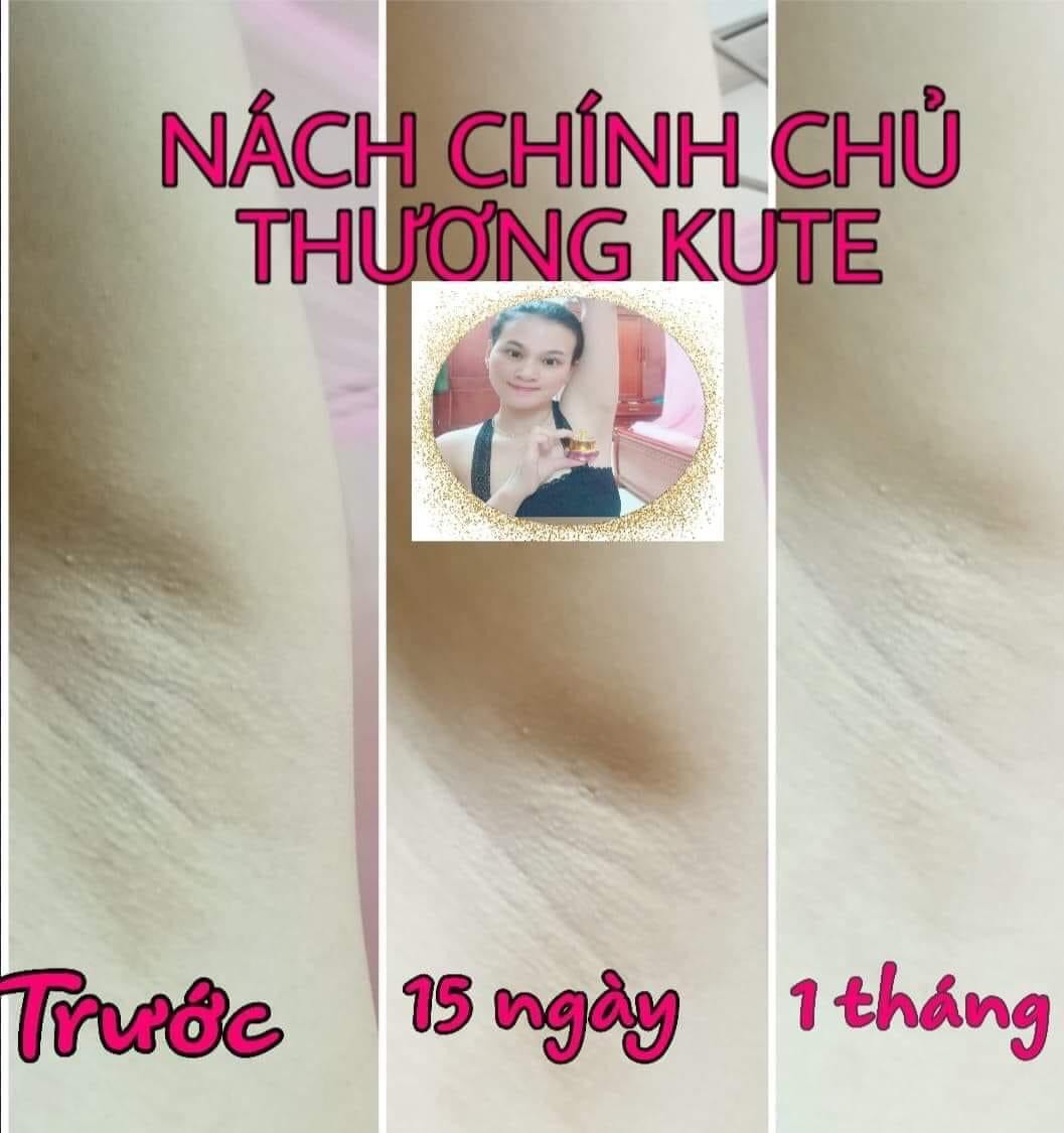 [HCM][HÀNG CHÍNH HÃNG] Kem Siêu Dưỡng Thâm 5S Biho Ladi