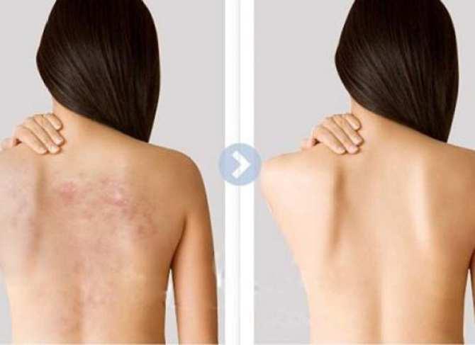 XÀ PHÒNG Y KHOA ATIDS 80G