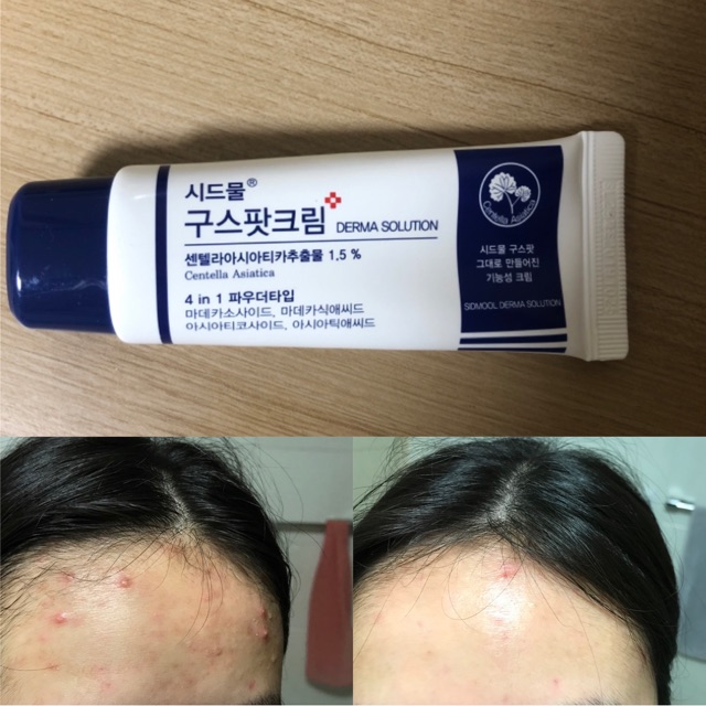 [HCM]Kem dưỡng da mụn Sidmool centella good spot cream 30ml