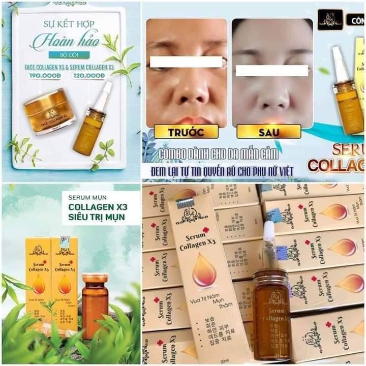 Serum mụn collagen x3 20ml