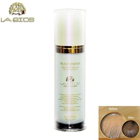 [CHÍNH HÃNG 100%] Tinh chất mọc tóc và ngăn rụng tóc Labios Scalp Essence 60ml