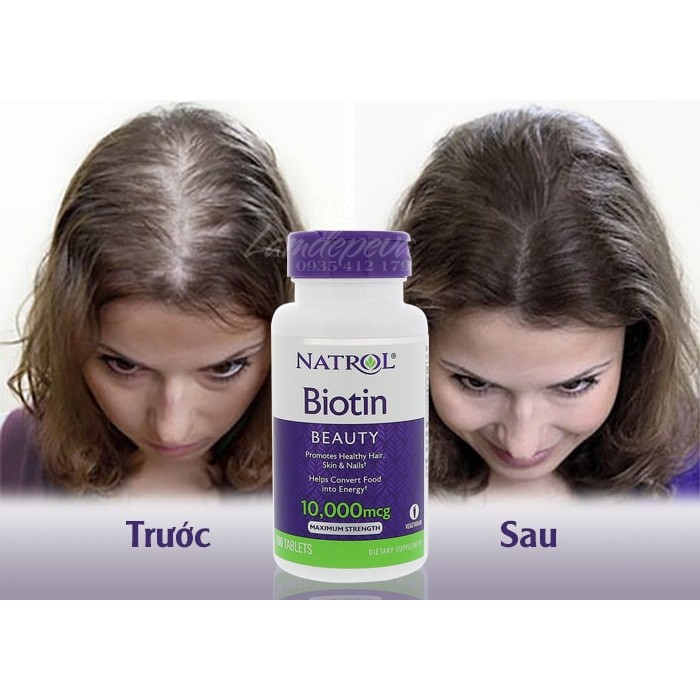 Viên uống khỏe tóc Natrol Biotin 10.000mcg Maximum Strength (100 viên)