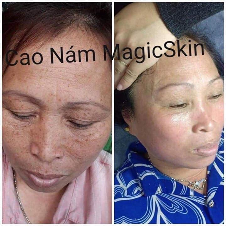 KEM CAO NAM SIZE NHO MAGIC SKIN