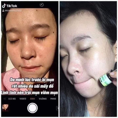 Serum Thảo Mộc Xanh Hàng Chính Hãng