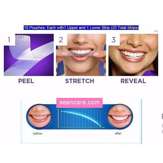 [HCM]Combo 14 miếng (7 gói/7 ngày) dán trắng răng Crest 3D White loại Supreme Professional - Mỹ