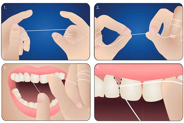 Chỉ nha khoa Dontodent kháng khuẩn, 100 m