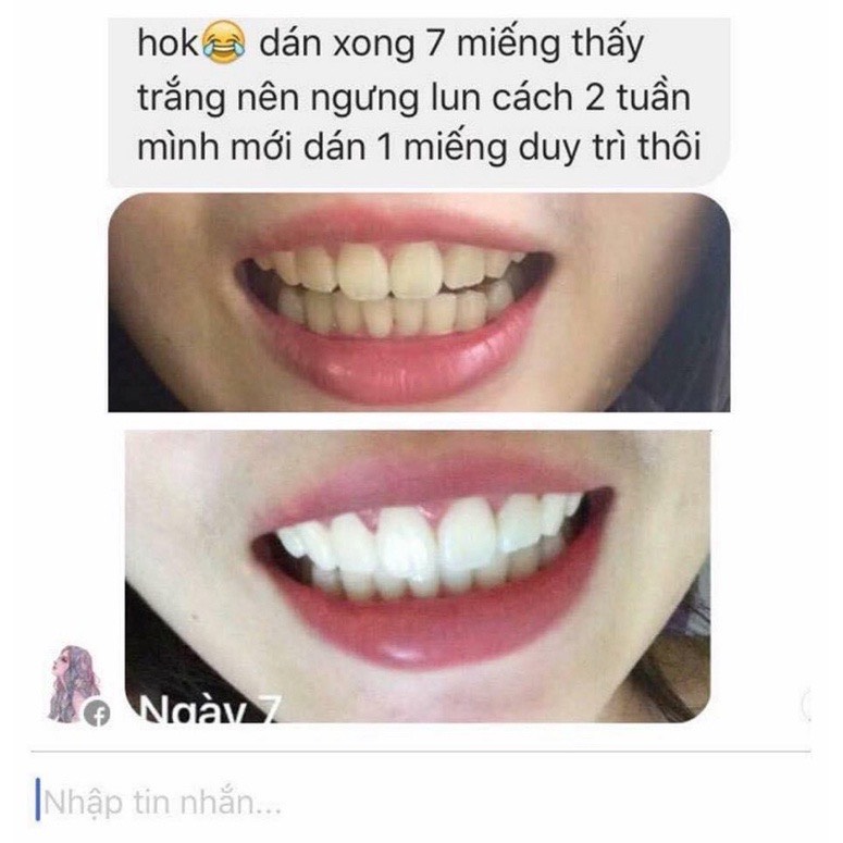 [GIẢM 5% ĐƠN 129K]Miếng dán trắng răng Crest