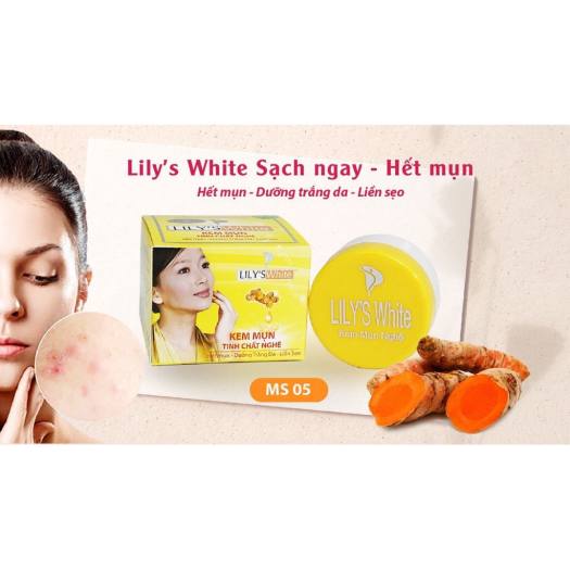 Kem mụn Lily’s White tinh chất nghệ