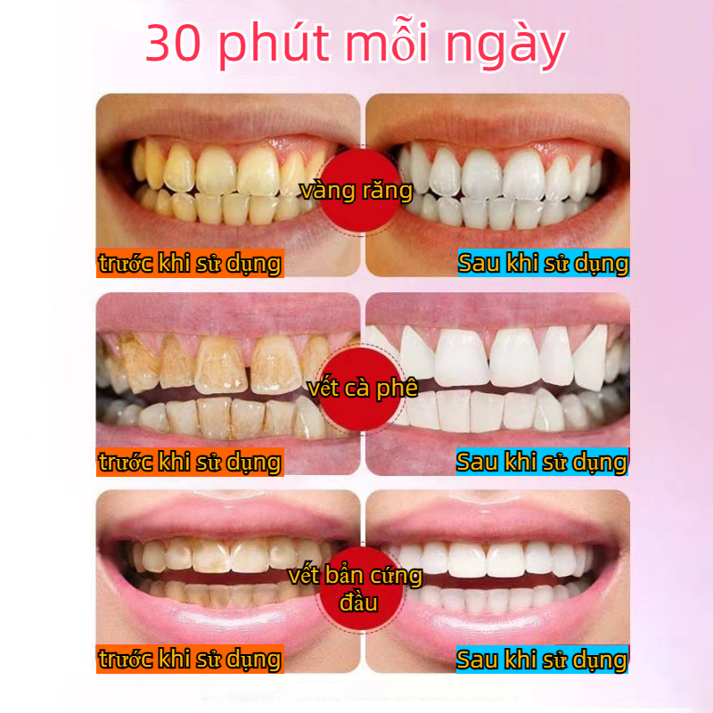 3D cool teeth whitening patch (1 bag of 2 stickers)