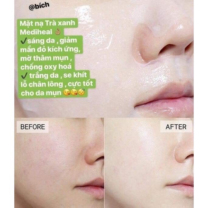 [HCM]Mặt nạ giấy Mediheal tea tree care solution essential mask EX